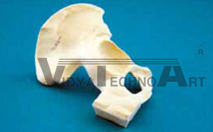 Acetabulum flat